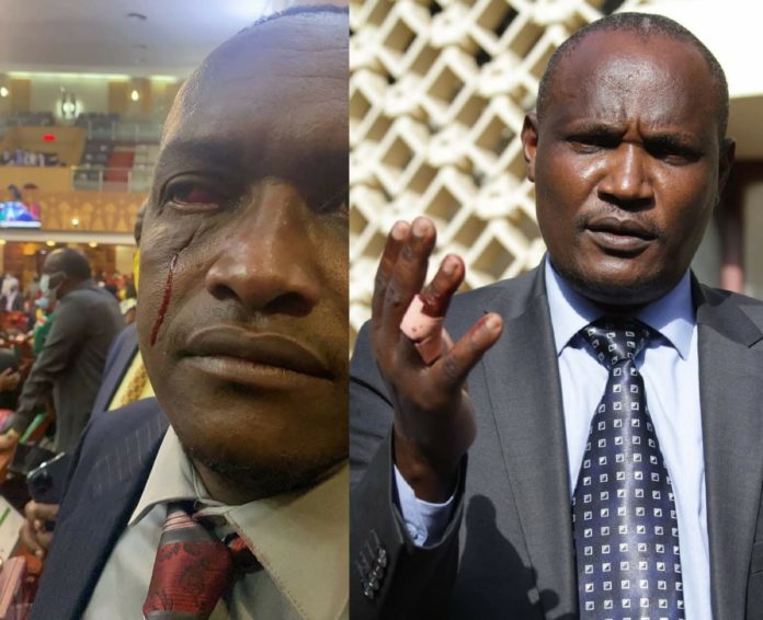 Ruto Allied MP Turns Into A Cannibal, Chews John Mbadi's Finger Like Ugali